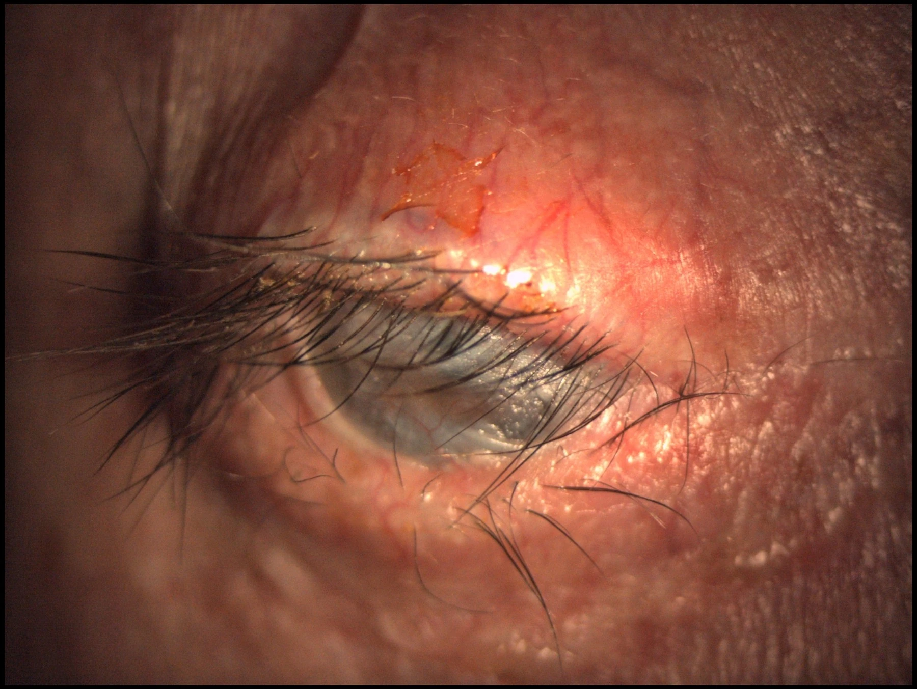 OOKP · Preoperative view